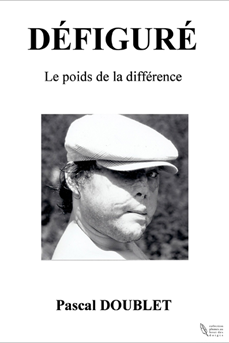 Handi-Livres 2013 : Meilleure Biographie : « Défiguré – Le poids de la différence », de Pascal Doublet